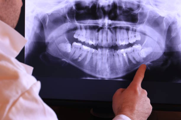 Best Emergency Dentist for Lost Fillings or Crowns in Feasterville, PA